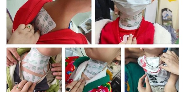 “呼吸道合胞病毒”高发季来袭！别把它当普通感冒