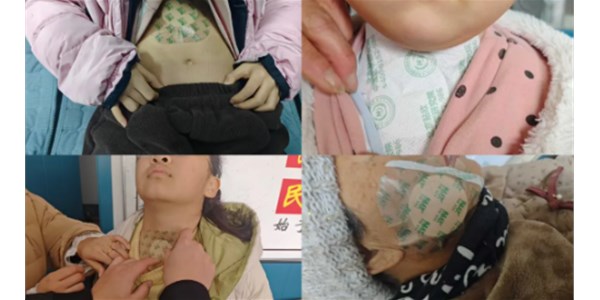 风邪当令，感冒多发？春季呼吸道养护，中医贴敷有妙招！